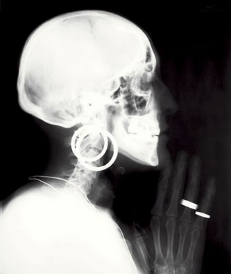 Meret Oppenheim x ray self